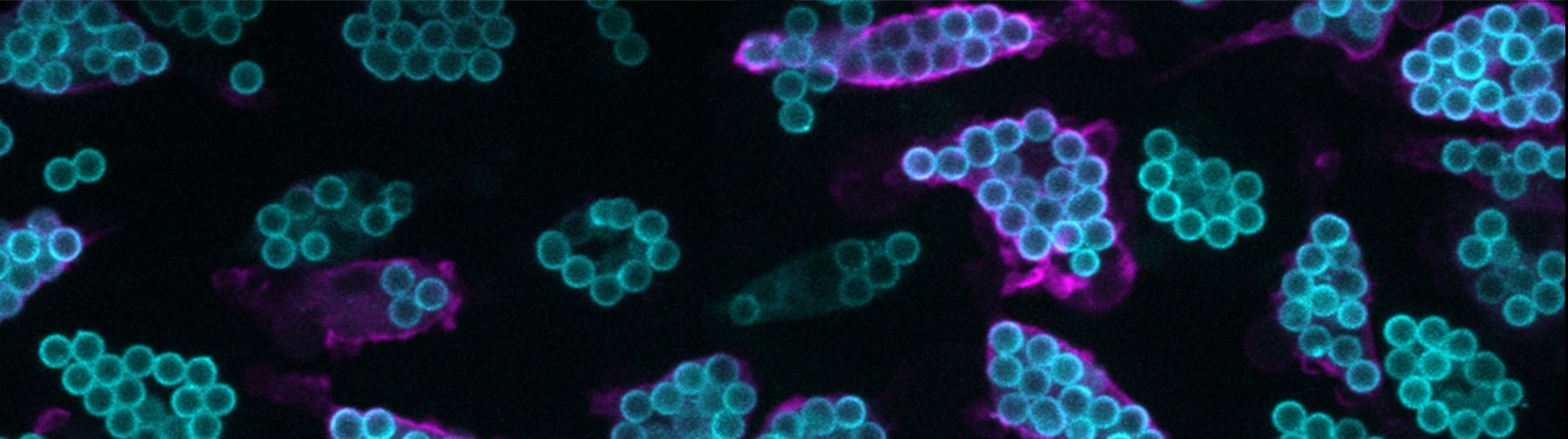 Image of macrophage with internalized beads.