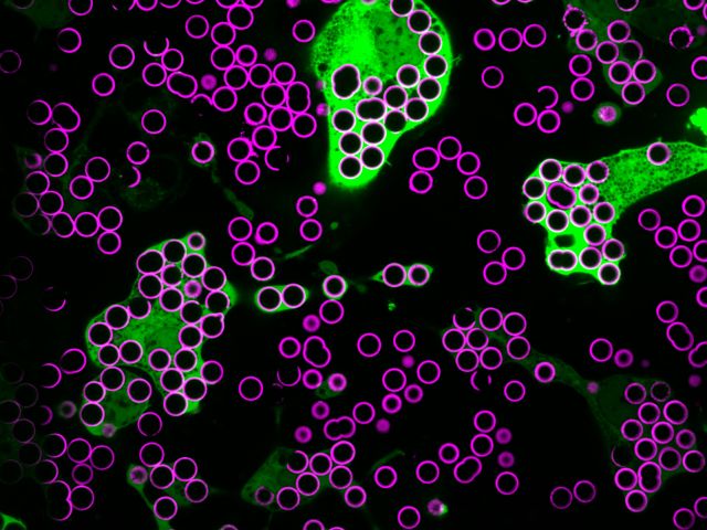 green macrophages phagocytosing magenta beads