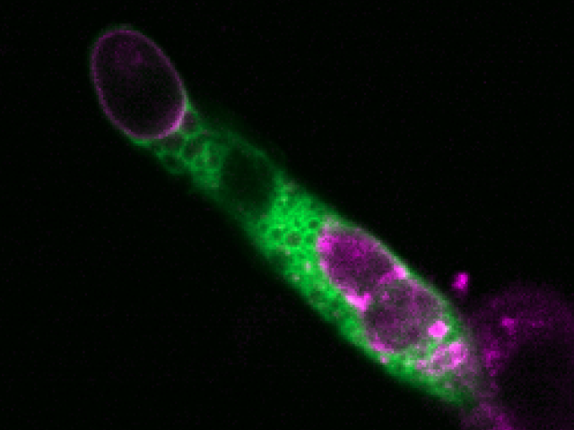 Image of macrophage phagocytosing multiple cancer cells