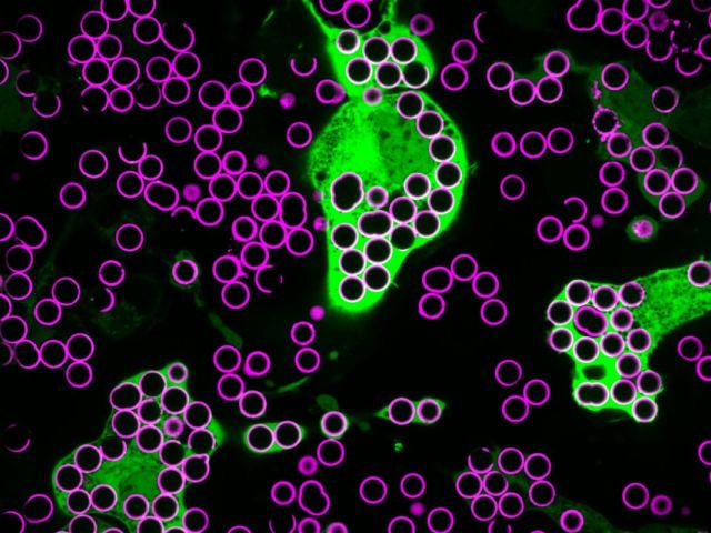 image of macrophages phagocytosing beads